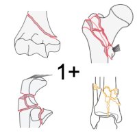 Complex Fractures JLA PSP (@complex_fracpsp) 's Twitter Profile