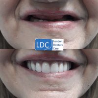 londondenturecare(@ChandaniPiru) 's Twitter Profile Photo