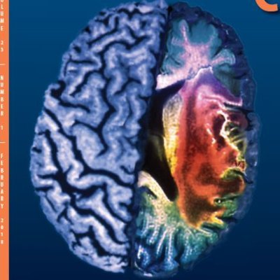 A Journal of Acute and Emergency Care. Official Journal of the @neurocritical  Indexed in PubMed.