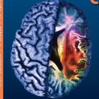 Neurocritical Care (@neurocritcarej) 's Twitter Profile Photo Neurocritical Care (@neurocritcarej) 's Twitter Profile Photo