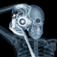 Radiology Monklands (@radiologyuhm) 's Twitter Profile
