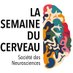 Semaine du Cerveau Toulouse (@sdc_toulouse_) Twitter profile photo Semaine du Cerveau Toulouse (@sdc_toulouse_) Twitter profile photo
