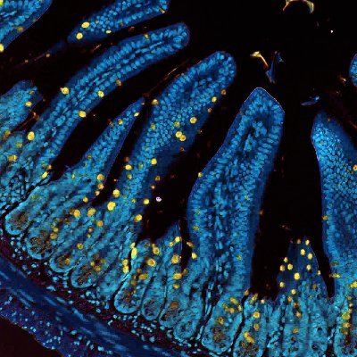 Immunology group at @TheCrick and @KingsCollegeLon studying unconventional T cells and mechanisms of immune responses to lipids. Run by the lab members.