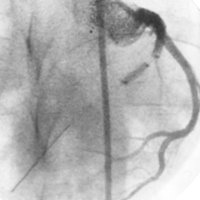 C.ZARAGOZA CARDIOMED (@cardiomedufv) 's Twitter Profile