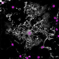 Advanced Light Microscopy_i3S (@alm_i3s) 's Twitter Profile