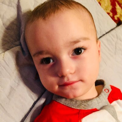 lucasjohnculp's profile picture. Lucas John Culp born was with a very rare genetic condition, Non-ketotic hyperglycinemia (NKH). Venmo @ Lucas-Culp-1 to help fund 3M for gene therapy.