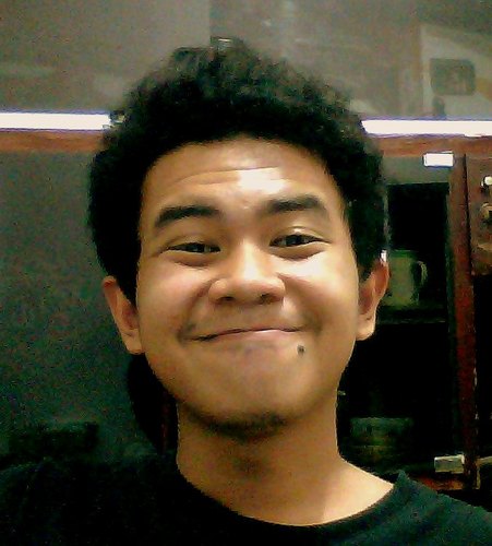Oromaxillo Facial Surgeon Gonnabe XD
Dentist Intern @ RSP Universitas Brawijaya