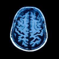 Delirium in the ICU (@icu_delirium) 's Twitter Profile