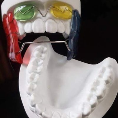 Specialists in:-
-Orthodontics Appliances(Fixed_removable)
-Removable Prosthesis
-Fixed Prosthesis
By⬇
D.T/ Abdelrahman Hassan