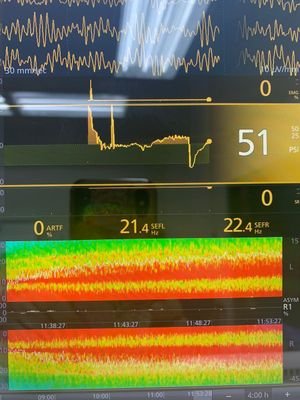 Brain34866943's profile picture. conectividad top down