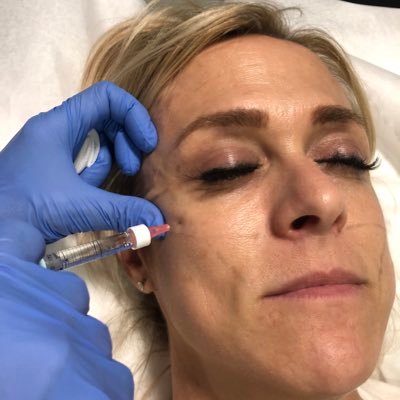 medical spa specializing in Laser Hair Removal, Tattoo Removal, IPL, FX, Botox, fillers, Microneedling, facials, and more