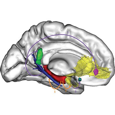 Multimodal Neuroimaging and Lifestyle in Ageing and Alzheimer's Disease | @Neuropresage | @Inserm