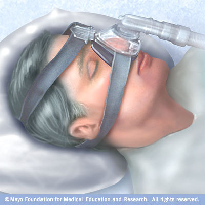 sleepapnea3's profile picture. Sleep apnea is a common but potentially dangerous sleep disorder can be characterized by repeated pauses in your breathing while asleep.