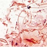 Microbiology lab teaching from Charing Cross Hospital. Scenarios fictitious. Unless specified, images of lab isolates/teaching slides, not diagnostic specimens.