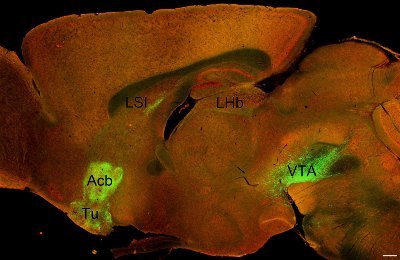 Aaron Roseberry's lab  at Georgia State University studies the neural control of feeding and body weight with a focus on the mesolimbic dopamine system.