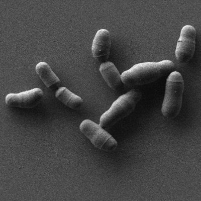 We're the Lab of Microbiome Immunobiology, IIET PAS. We specialize in #surfaceantigens #microbiome #probiotics #allergy #neuro #mucose #nmr #colitis #ibd #EVs.