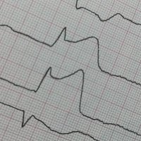 NOpticusII (@opticusn) 's Twitter Profile