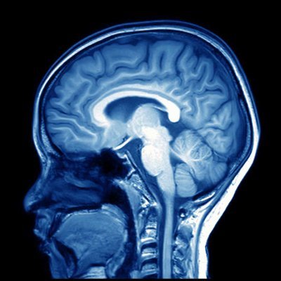 Research lab at @umich @umichmedicine investigating the neural bases of stuttering. Follow for updates from the field and news from our studies! PI @sooeunchang