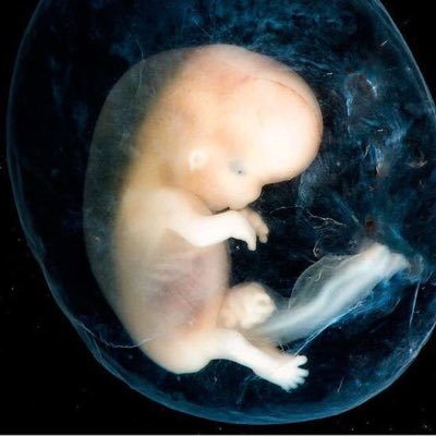 ocousino's profile picture. No podemos SER si no nos dejan Nacer. Creo en el valor infinito de cada ser humano y su derecho a vivir.