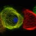 Imperial Stem Cell Regenerative Medicine Network (@impstemregen) Twitter profile photo Imperial Stem Cell Regenerative Medicine Network (@impstemregen) Twitter profile photo