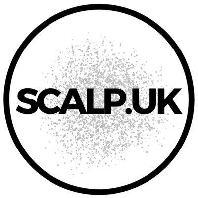 Scalp Micropigmentation UK • Based in Chester • Non surgical hairloss solution