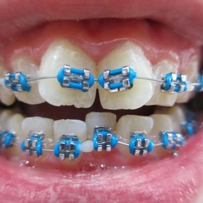 cirugião dentista com foco em implantodontia e ortodontia