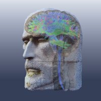 Radiología Hospital Universitario Ramón y Cajal (@radiologiaryc) 's Twitter Profile