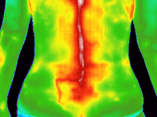 EarlyDetectionC's profile picture. At Early Detection Centers of America we are dedicated to help improve and monitor your health by using Medical Digital Infrared Thermal Imaging.