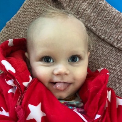 isla_all's profile picture. Quest to raise £3m for gene therapy
Isla has rare condition called NKH
https://t.co/AEHaqHNrF1