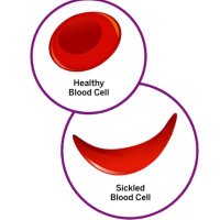 Sickle Cell Awareness Foundation (@awareness_cell) Twitter profile photo