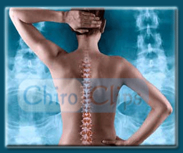 ChiroClips offers sophisticated, contemporary clipart designed for chiropractors. Chiropractic logos, icons, caduceus, anatomical illustrations, cartoons.