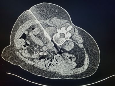 SAR cross sectional interventional radiology commission