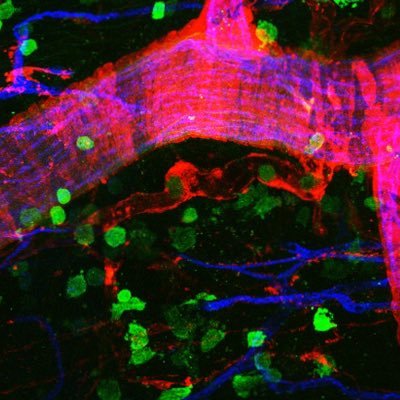 ImmunoRegenerative engineering lab at the Wallace H. Coulter Department of Biomedical Engineering at Georgia Tech and Emory.