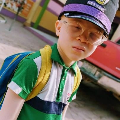 ALBINOROCKS (ABOUT US)
Our aim is to raise awareness in Africa and beyond, to thoroughly educate, empower and offer assistance to People Living with Albinism