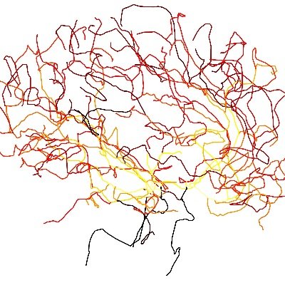 Cerebral Haemodynamics Research Group (腦血流動力學研究室) Profile