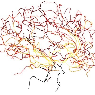 Updates on cerebral blood flow and metabolism from Cerebral Haemodynamics Group (run by Stephen Payne). National Taiwan University / University of Oxford.