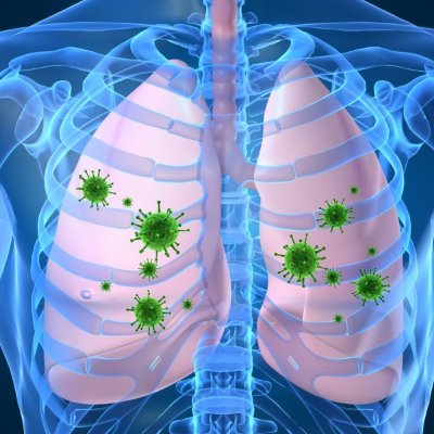 Streptococcus pneumoniae OFICIAL, llevo en este mundillo desde 460 aC – 370 aC, así que coronavirus retírate, estas de moda pero yo soy mejor.