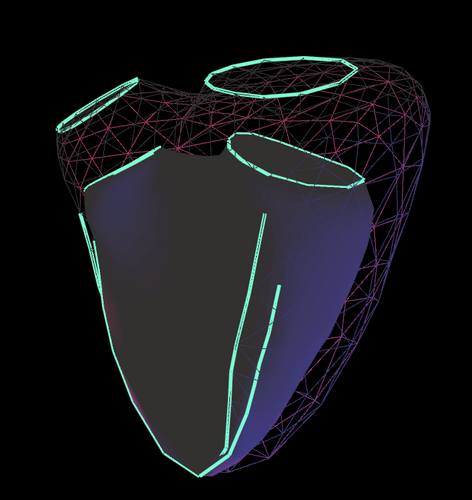 Creating 3D volumetric cardiac measurements from standard 2D Echo w/ accuracy equivalent to MRI (#TSXV: $VPT |  #OTCQB: $VPTDF )