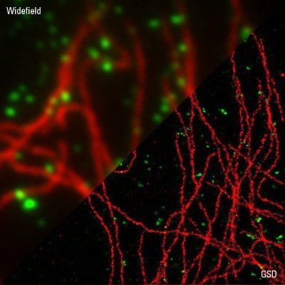 Confocal, multiphoton, and high-resolution microscopy... making a difference in imaging cutting edge research with cutting edge technology!