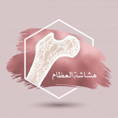 نحن طالبات مسار صحي 👩🏻‍⚕️💗 ، الشعبة HF02 تحت إشراف د/ تغريد أحمد السيد أحمد 🌸 ، قمنا بهذه الحملة بهدف التوعية بشأن الرياضة وعلاقتها بهشاشة العظام ✨ .