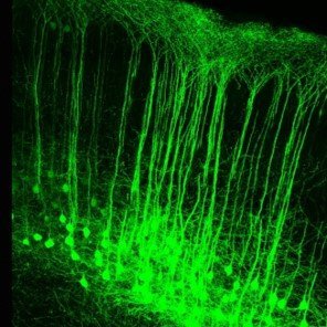 We study the functional organization of the auditory system. We are particularly interested in top-down modulation and the impact of aging.