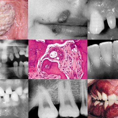 Patología Oral FOUSAC.