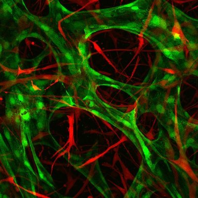 The Haase group develops novel 3D vascularised in vitro tissues for disease modelling, drug development and regenerative medicine at @EMBLBarcelona
🧬🧪🧫⚗️🔬