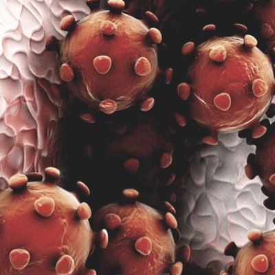 Co_bulos19's profile picture. 3 estudiantes de enfermería con ganas de mantenerte informado. 👦👨🧔
¿Qué es cierto de lo que te han dicho sobre el nuevo covid-19?