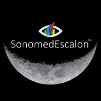 Sonomed Escalon (@sonomedescalon) 's Twitter Profile Photo