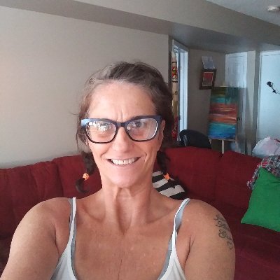 Born with Ollier's disease, 50 surgeries strong, supporting families with a RAREsie, like me! Raising funds for Educational Scholarships. VOLUNTEER position. 💪