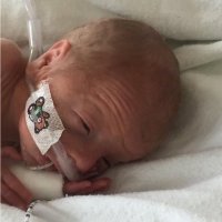 Y&HNeonatalODN (@yhneonet) 's Twitter Profile Photo Y&HNeonatalODN (@yhneonet) 's Twitter Profile Photo
