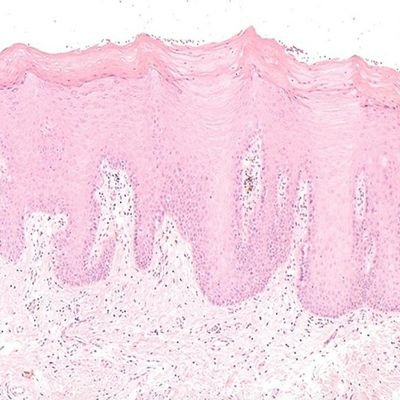 Specialist oral pathologist. Tweeting excerpts from the oral path textbook that, let's face it, I'll never get around to actually writing. #oralpath #entpath