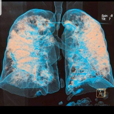 ID_Superheroes's profile picture. anesthesiology/criticalcare,#fellowshipCanada,#Pocus