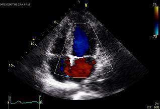 Physician & Non-Invasive cardiologist